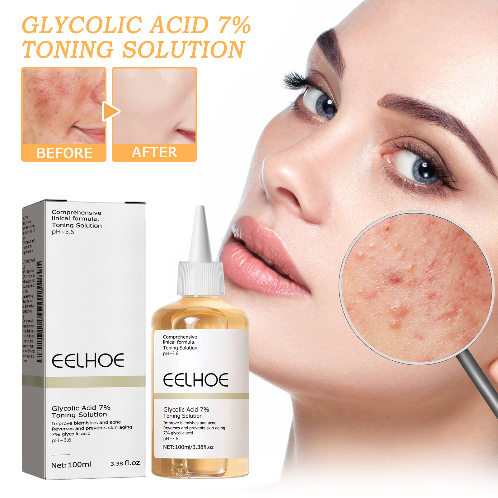 100ml Glycolic Acid Toning Sol - đánh giá và giá Lactic Acid Toner