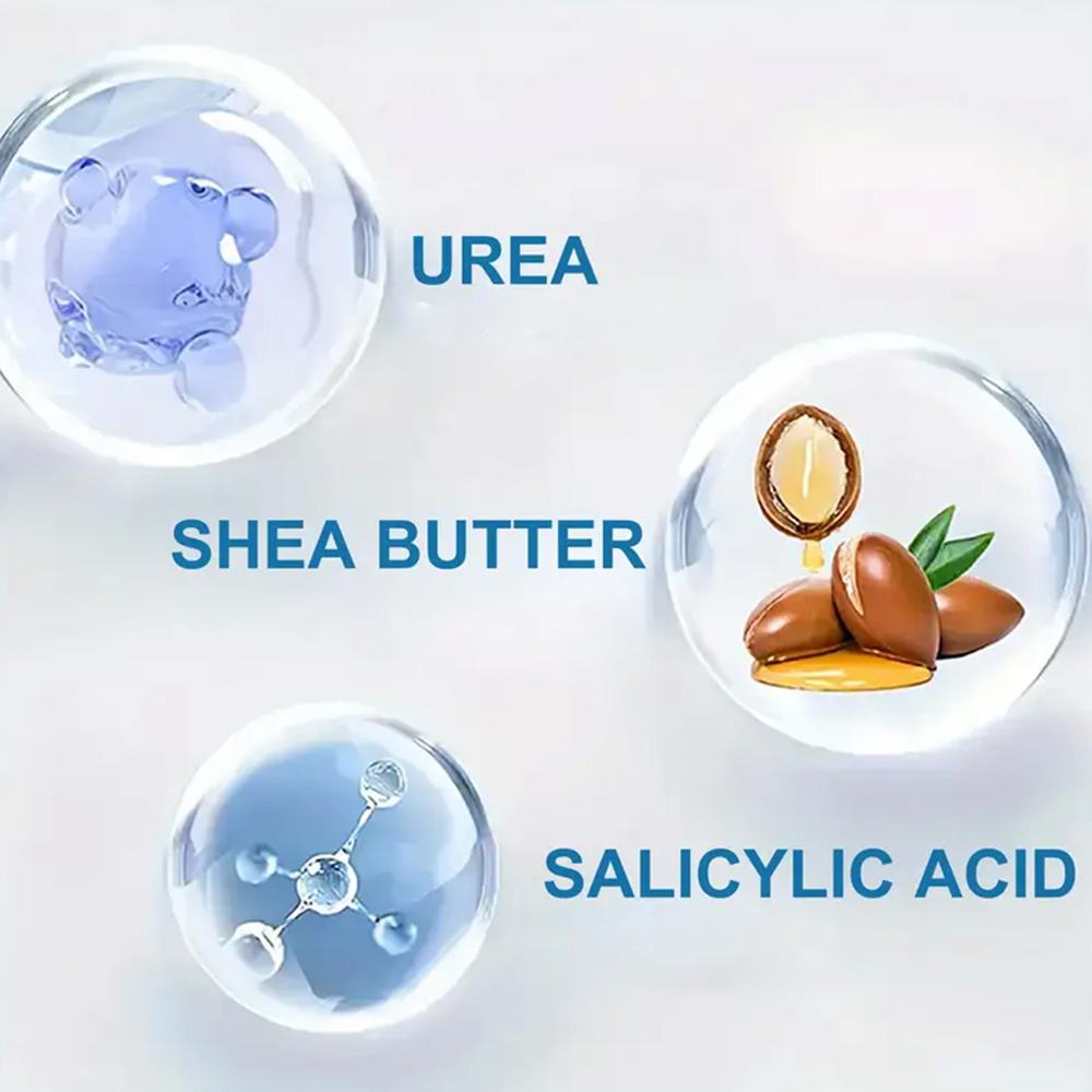 YOUNGCOME 250G Urea Cream with - đánh giá và giá Urea Foot Cream