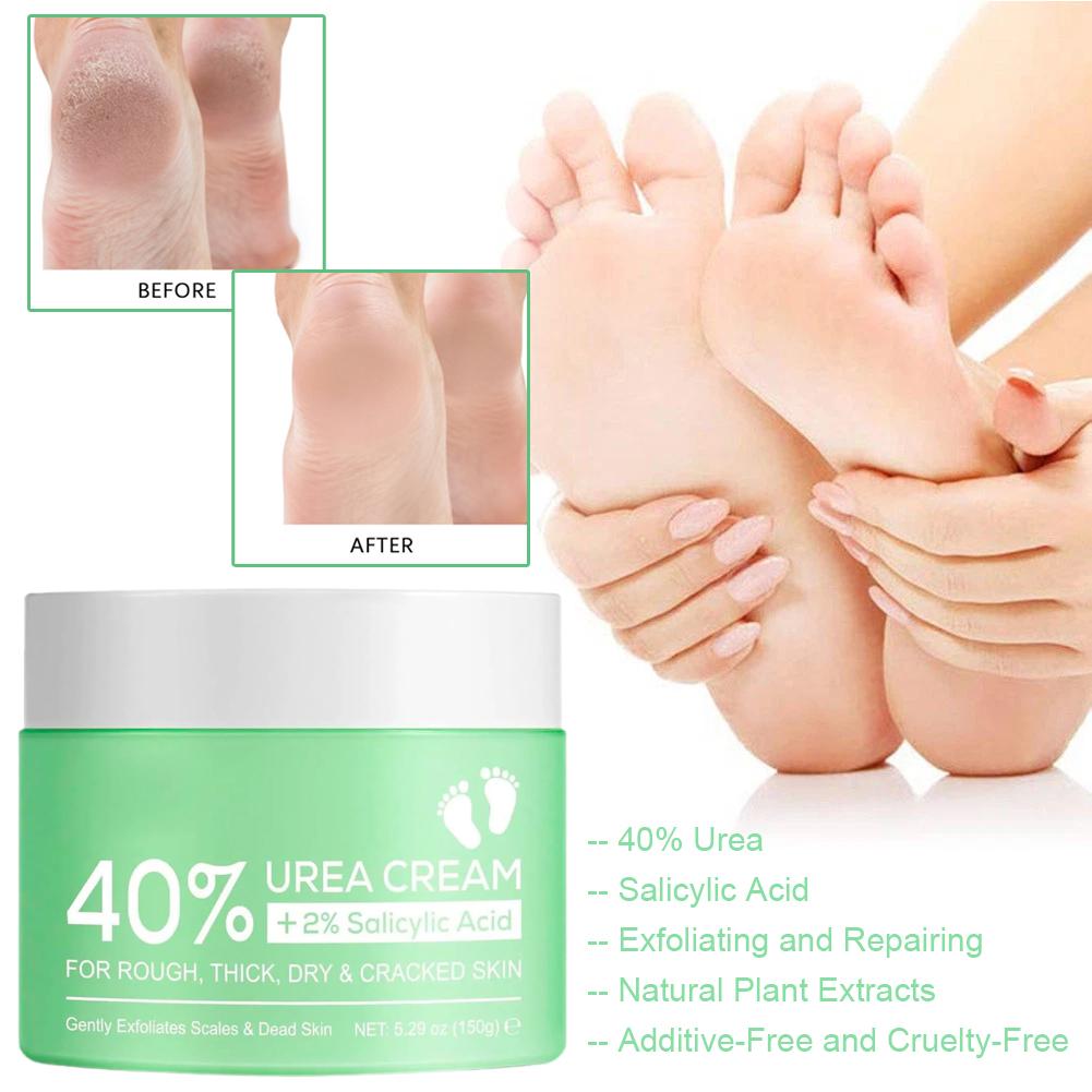 40% Urea Cream for Hands and F - đánh giá và giá Urea Foot Cream
