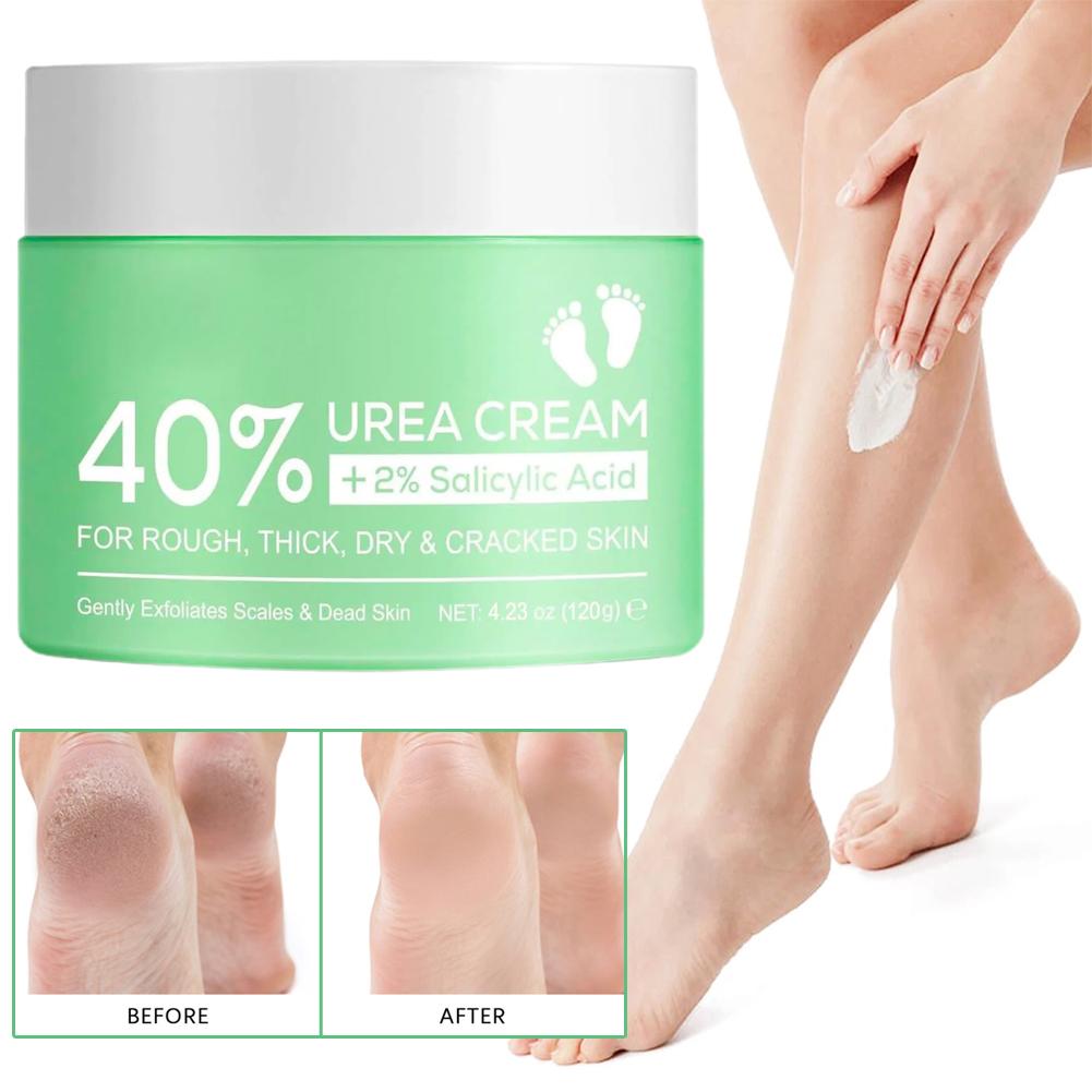 40% Urea Cream for Hands and F - đánh giá và giá Urea Foot Cream