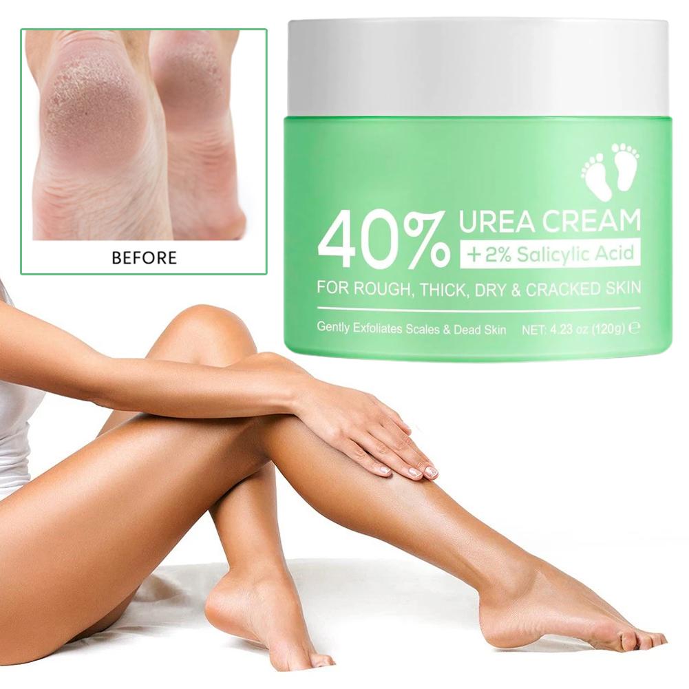 40% Urea Cream for Hands and F - đánh giá và giá Urea Foot Cream