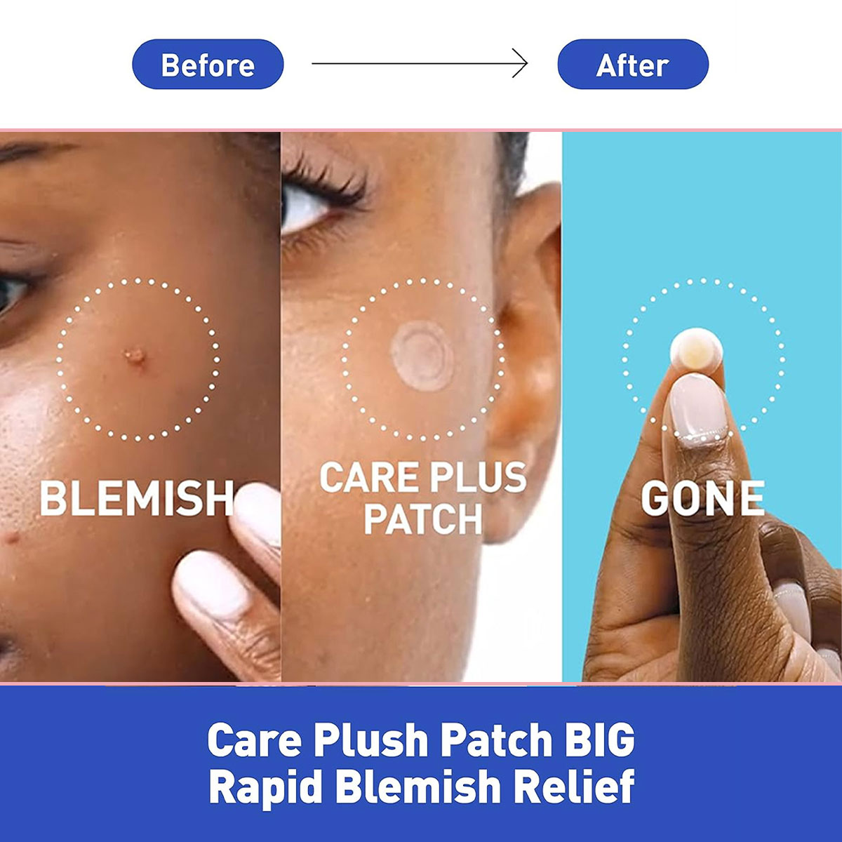 Olive Young Care Plus Spot Cov - đánh giá và giá Skincare Moisturizer