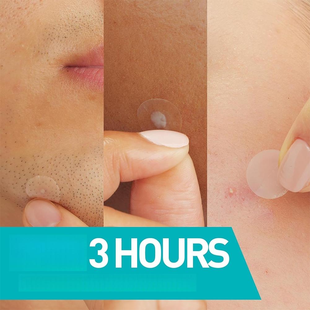 Invisible Pimple Patch 24/200/ - đánh giá và giá Skincare Moisturizer