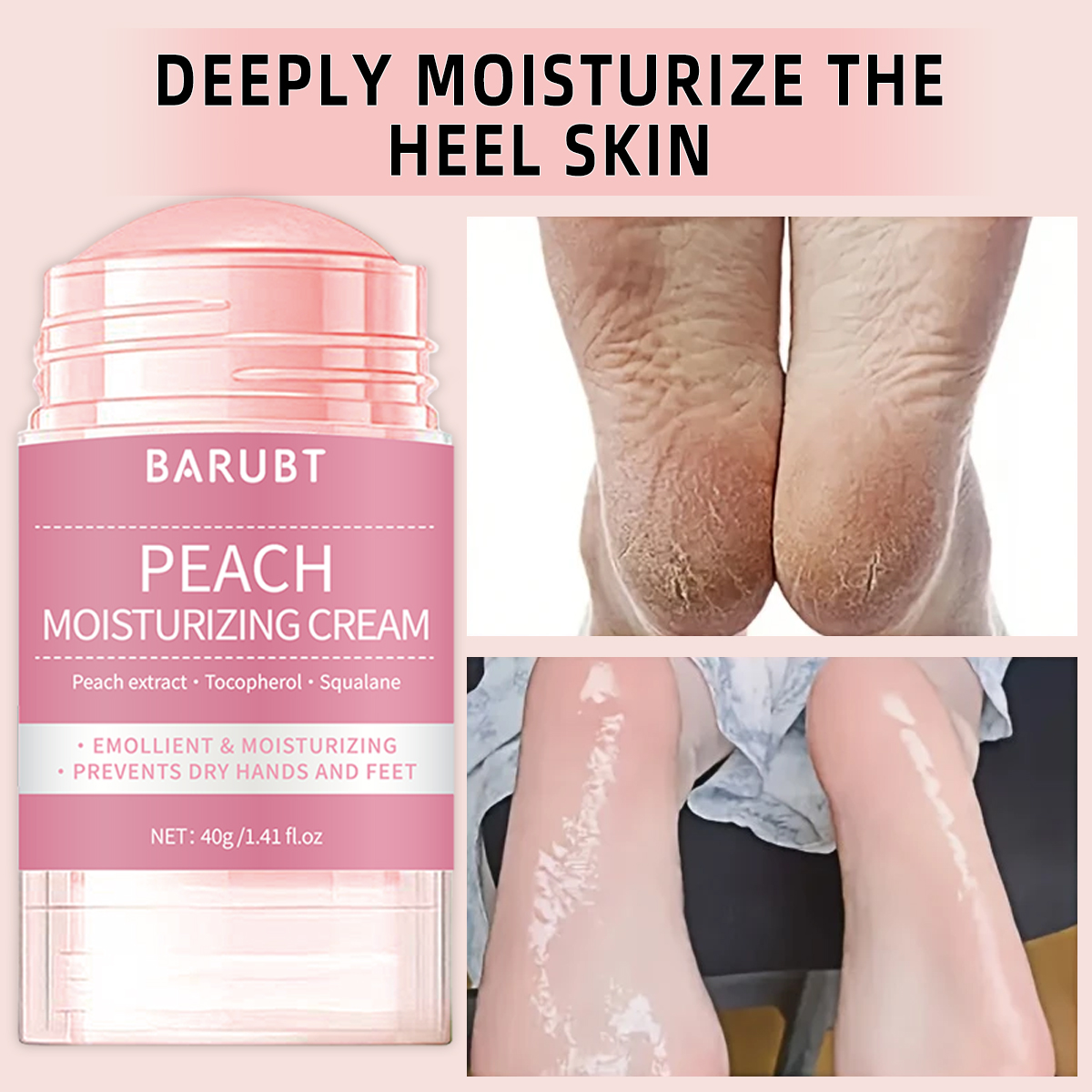 Peach urea mud film rod, salic - đánh giá và giá Urea Foot Cream