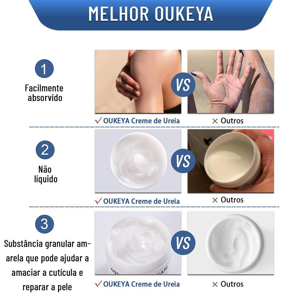Urea Cream 40% Moisturizing An - đánh giá và giá Urea Foot Cream