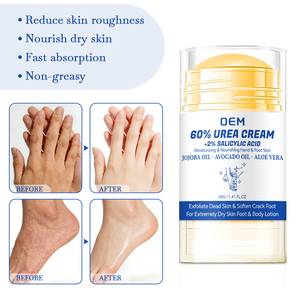 60% Urea Foot Cream + 2% Salic - đánh giá và giá Urea Foot Cream