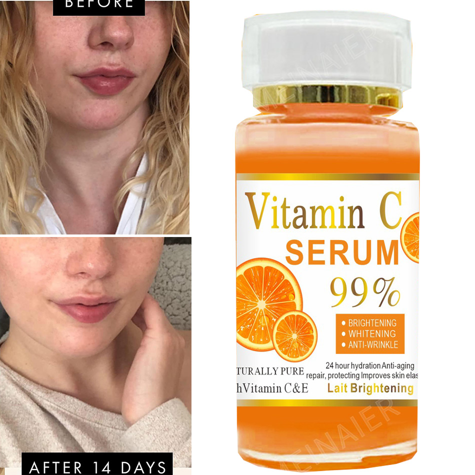 120ml 99% Vitamin C Serum Oil  - đánh giá và giá Alpha Arbutin Serum