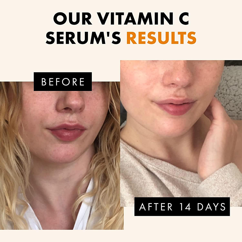 120ml 99% Vitamin C Serum Oil  - đánh giá và giá Alpha Arbutin Serum