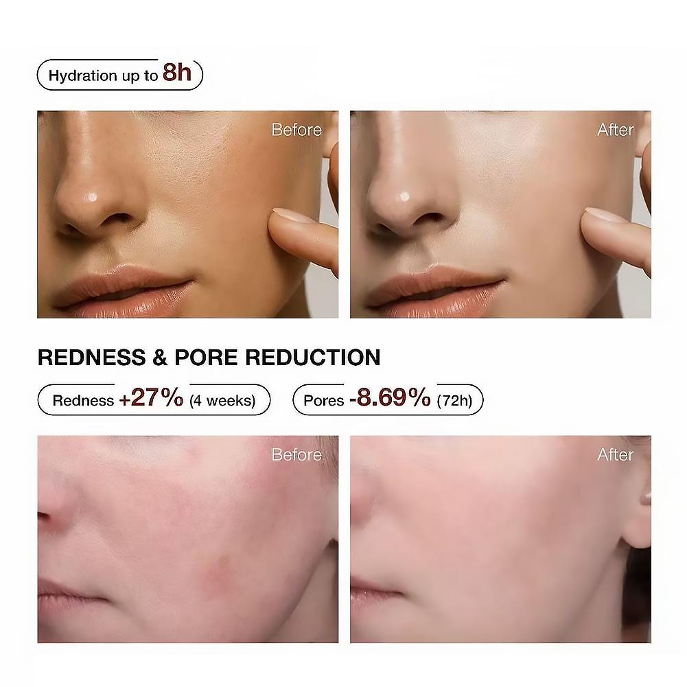 5% Niacinamide & Arbutin Serum - đánh giá và giá Alpha Arbutin Serum