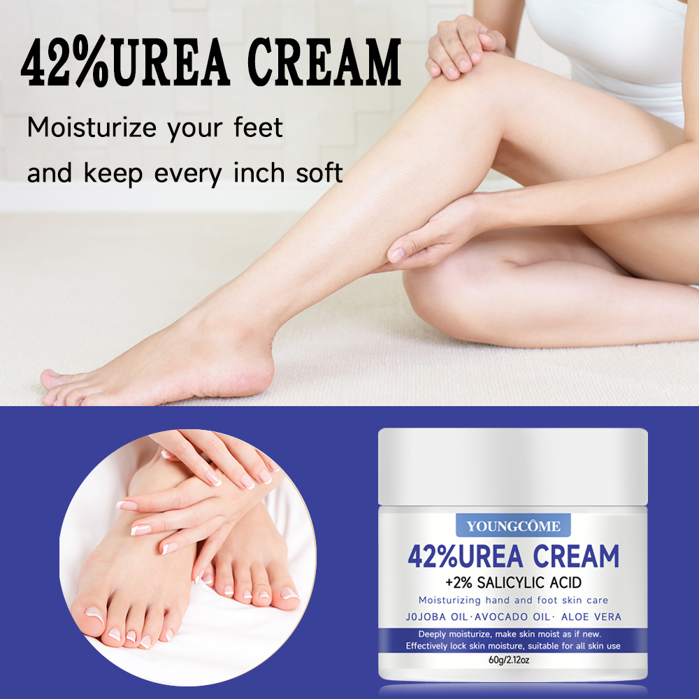 YOUNGCOME 42% urea cream +2% s - đánh giá và giá Urea Foot Cream