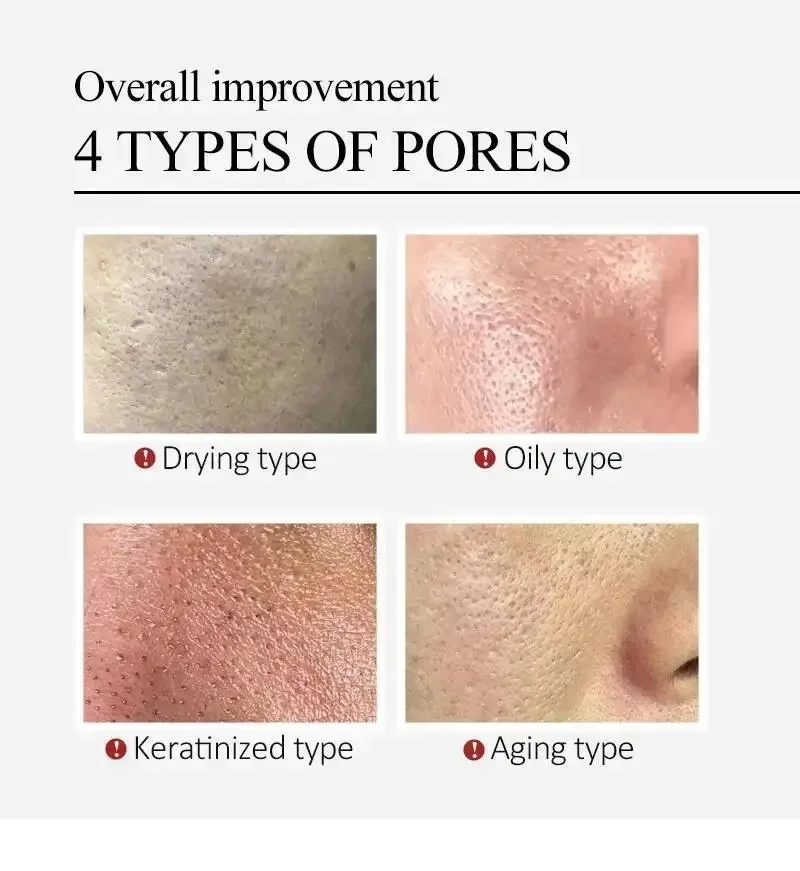 Centella Asiatica Shrink Pores - đánh giá và giá Lactic Acid Toner