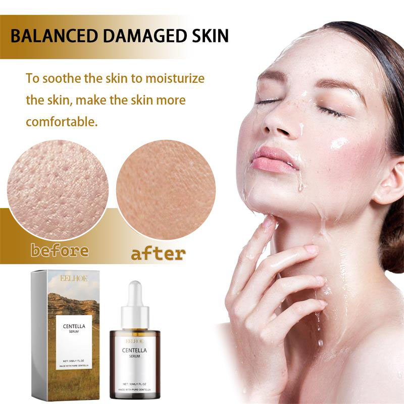 Centella Asiatica Shrink Pores - đánh giá và giá Lactic Acid Toner