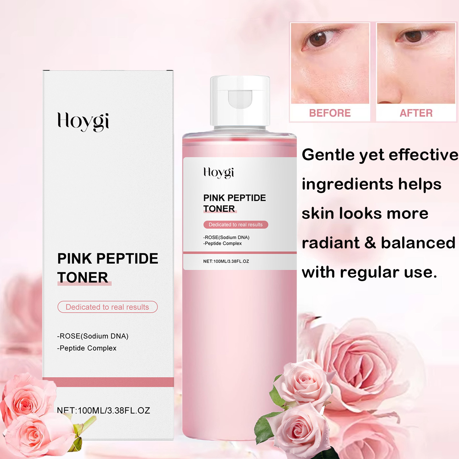 Rose Essence Toner Glowing Ski - đánh giá và giá Lactic Acid Toner