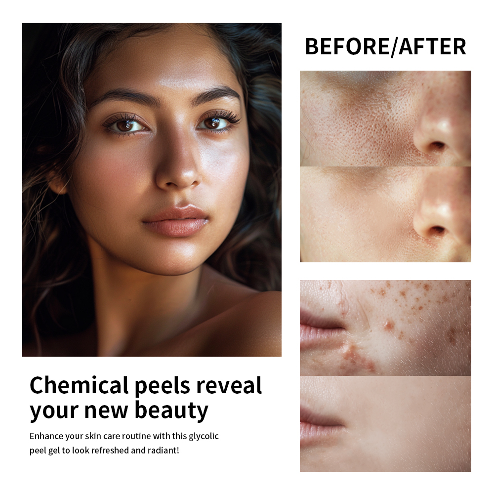 30% Glycolic Acid Face Care Lo - đánh giá và giá Lactic Acid Toner