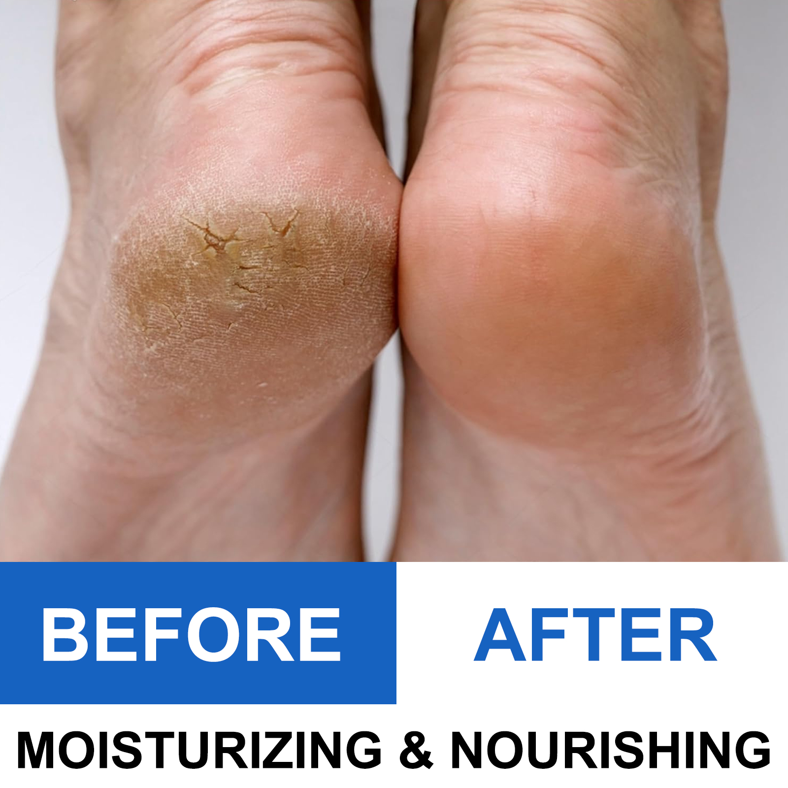40% Urea Foot Cream Stick - Mo - đánh giá và giá Urea Foot Cream
