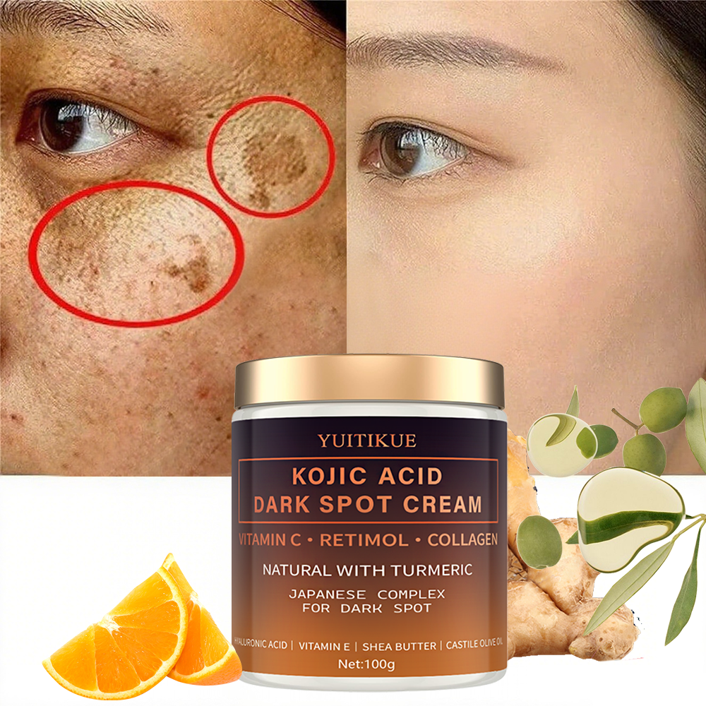 Arbutin fading cream, Vitamin  - đánh giá và giá Retinol Vitamin A Cream